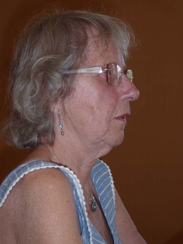 P1190500